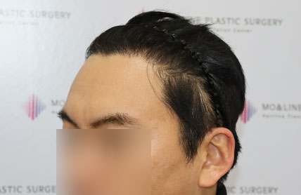 치료후기 이미지