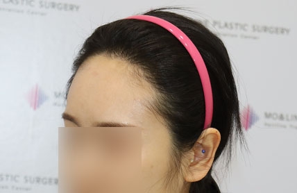 치료후기 이미지