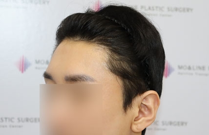 치료후기 이미지