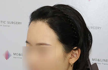 치료후기 이미지