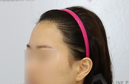 치료후기 이미지