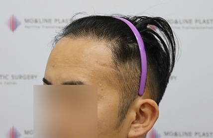 치료후기 이미지