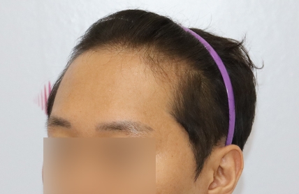 치료후기 이미지