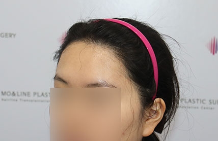치료후기 이미지