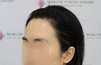 치료후기 이미지