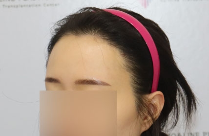 치료후기 이미지