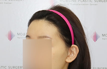 치료후기 이미지