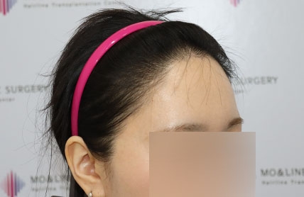 치료후기 이미지