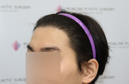 치료후기 이미지