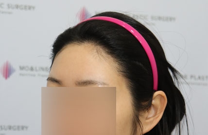 치료후기 이미지