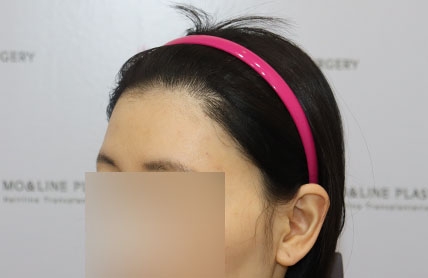 치료후기 이미지