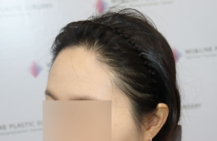 치료후기 이미지