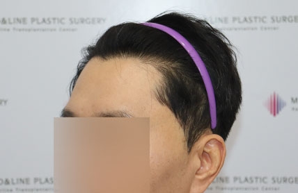 치료후기 이미지