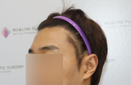 치료후기 이미지