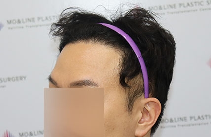치료후기 이미지