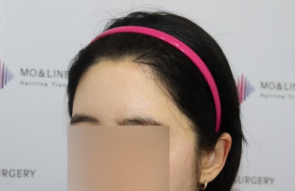 치료후기 이미지