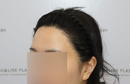 치료후기 이미지
