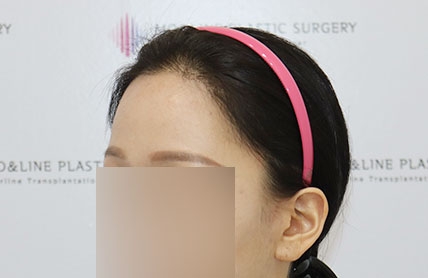 치료후기 이미지
