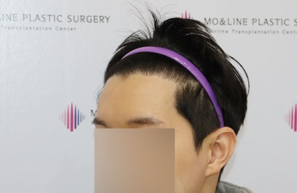 치료후기 이미지