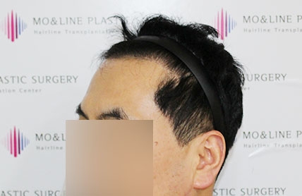 치료후기 이미지