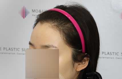 치료후기 이미지