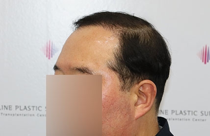 치료후기 이미지