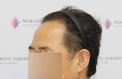 치료후기 이미지