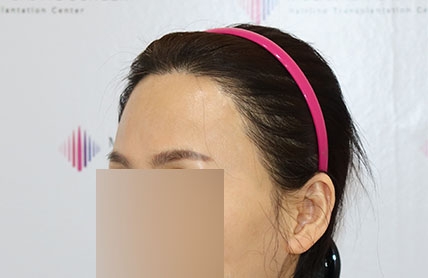 치료후기 이미지