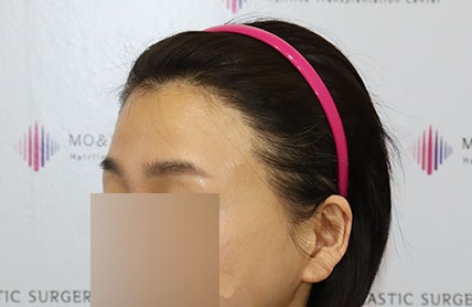 치료후기 이미지