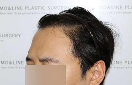 치료후기 이미지