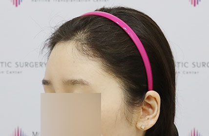 치료후기 이미지