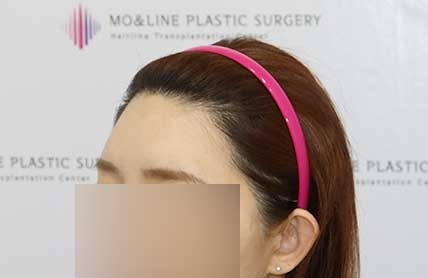 치료후기 이미지