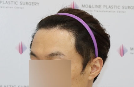 치료후기 이미지
