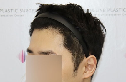 치료후기 이미지