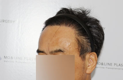 치료후기 이미지