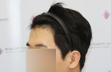 치료후기 이미지