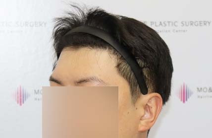 치료후기 이미지