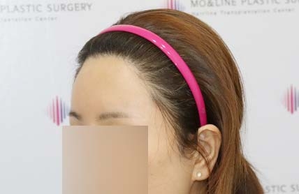 치료후기 이미지