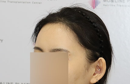치료후기 이미지