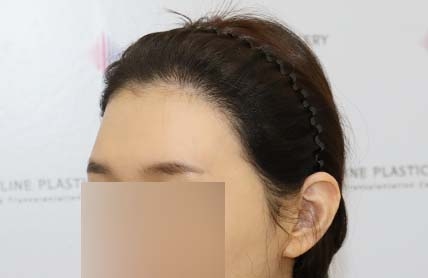 치료후기 이미지