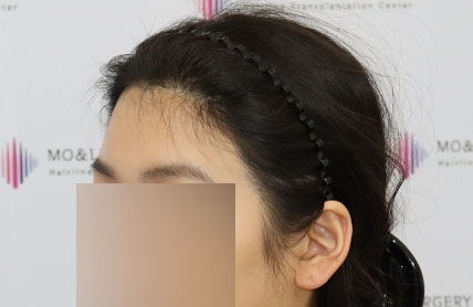 치료후기 이미지