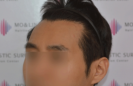 치료후기 이미지