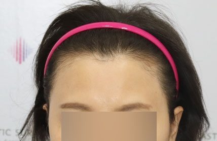 치료후기 이미지